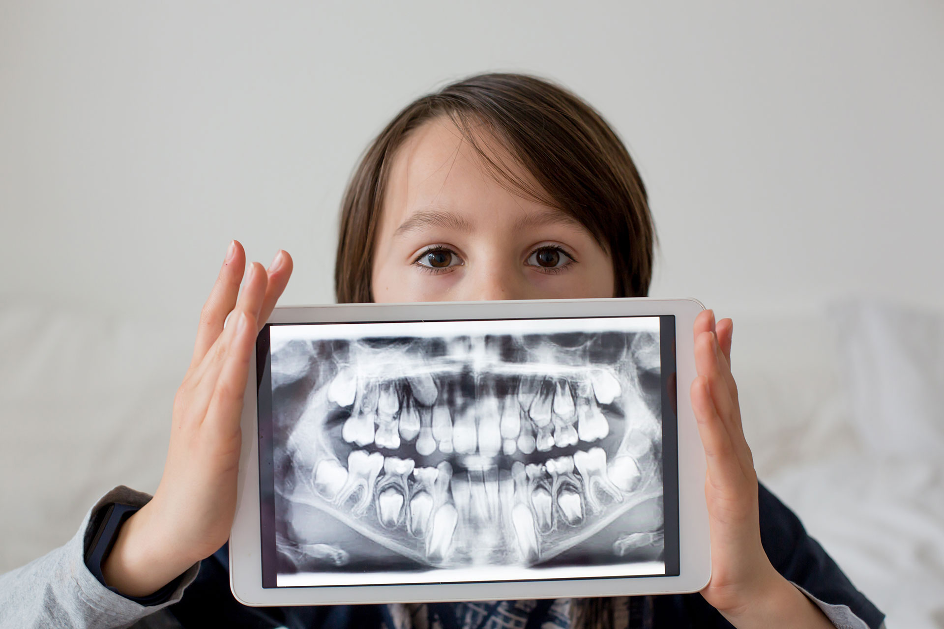 A young child holding a tablet displaying an X-ray of their teeth, with the child s face partially obscured by the tablet.