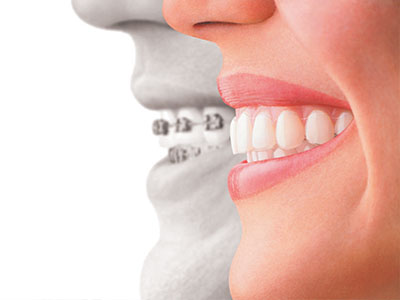 The image features a split-face graphic with one side showing a person s face and the other side showing a dental bridge, illustrating the transformation from natural teeth to a dental implant.