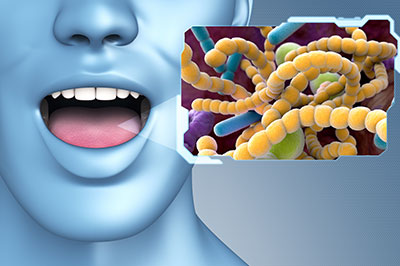 The image features a 3D rendering of a human head with an open mouth, next to a graphic of bacteria and viruses.